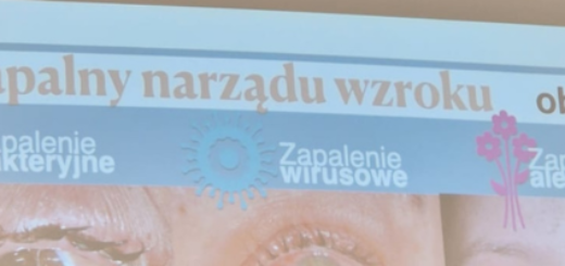 baner do wpisu choroby oczu zachowaj wzrok